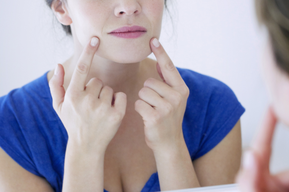 Lines Causes, Best Treatments and Prevention