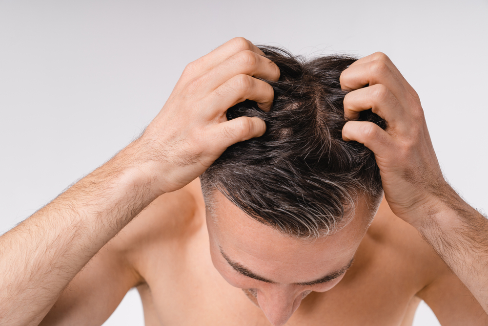 Scalp Scabs Causes Treatments When To See A Doctor And More